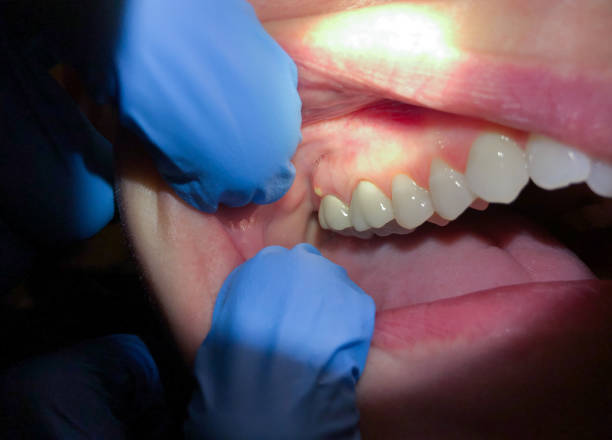 Best Mobile Emergency Dentist in Desert Edge, CA